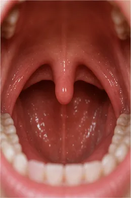 Illustration of the little uvula hang at the back of your mouth for the question "Why does the little uvula hang at the back of your mouth?"