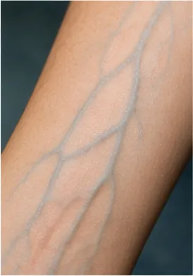 Illustration of veins look blue through skin when blood is red for the question "Why do veins look blue through skin when blood is red?"