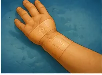 Illustration of skin heal after a cut for the question "How does skin heal after a cut?"